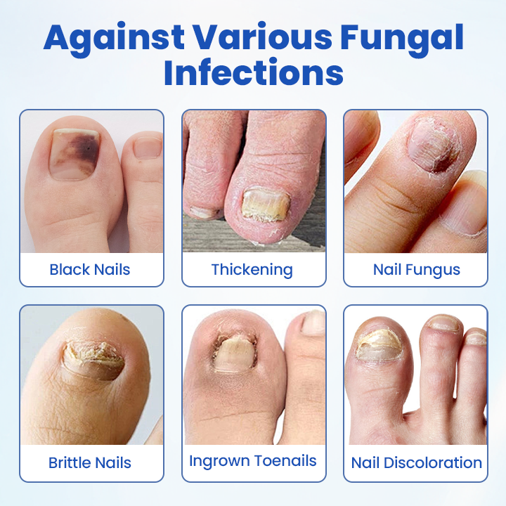 FungalPatch - Antibacterial Fungal Patch