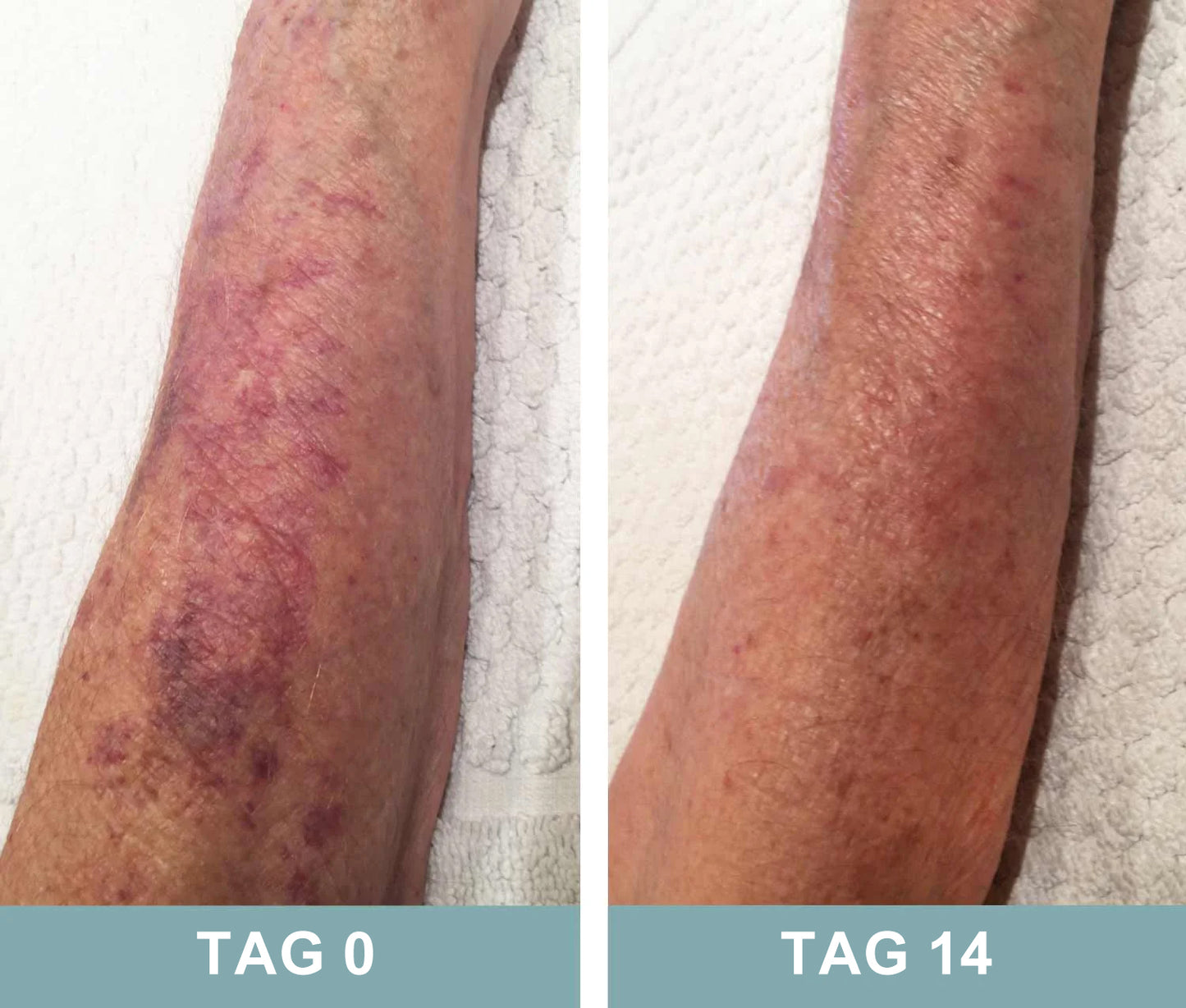 Natravor® Black Rice Skin Repair Essence Cream ⚕️ FDA Certified (Removes warts and skin growths, improves keratin buildup and seborrheic dermatitis, follicular keratosis, age spots, and bruising)